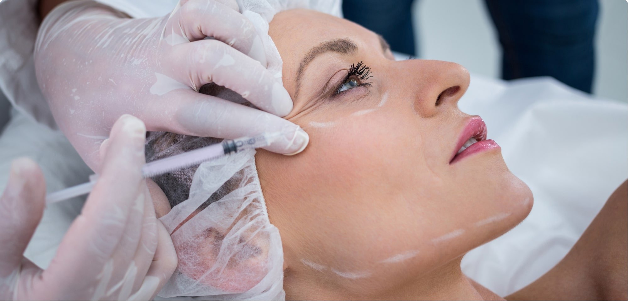 Mengenal Botox, Perawatan Wajah Untuk Mengurangi Kerutan